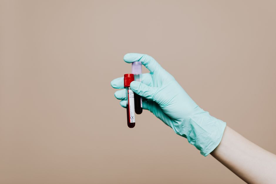 Why Your Vet Wants Blood Work For Your Dog